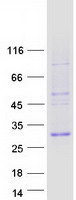 TWIST1 / TWIST Protein - Purified recombinant protein TWIST1 was analyzed by SDS-PAGE gel and Coomassie Blue Staining
