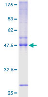 TWIST2 Protein - 12.5% SDS-PAGE of human TWIST2 stained with Coomassie Blue