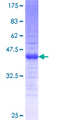 TWIST2 Protein - 12.5% SDS-PAGE Stained with Coomassie Blue.