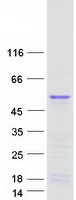 TWISTNB Protein - Purified recombinant protein TWISTNB was analyzed by SDS-PAGE gel and Coomassie Blue Staining