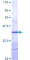 TXK / RLK Protein - 12.5% SDS-PAGE Stained with Coomassie Blue.