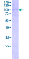 TXK / RLK Protein - 12.5% SDS-PAGE Stained with Coomassie Blue