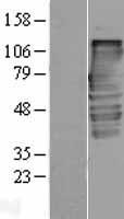 TXLNA / Alpha Taxilin Protein - Western validation with an anti-DDK antibody * L: Control HEK293 lysate R: Over-expression lysate