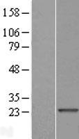 TXLNGY / CYorf15B Protein - Western validation with an anti-DDK antibody * L: Control HEK293 lysate R: Over-expression lysate