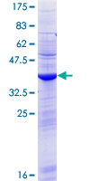 TXLNGY / CYorf15B Protein
