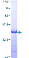 TXN / Thioredoxin / TRX Protein - 12.5% SDS-PAGE Stained with Coomassie Blue.