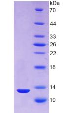 TXN / Thioredoxin / TRX Protein - Recombinant Thioredoxin By SDS-PAGE