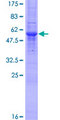 TXNDC1 / TMX1 Protein - 12.5% SDS-PAGE of human TXNDC stained with Coomassie Blue