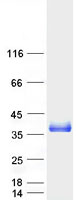 TXNDC1 / TMX1 Protein - Purified recombinant protein TMX1 was analyzed by SDS-PAGE gel and Coomassie Blue Staining