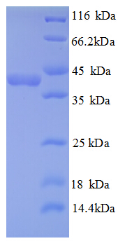 TXNDC17 Protein