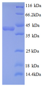 TXNDC17 Protein