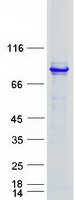 TXNDC3 Protein - Purified recombinant protein NME8 was analyzed by SDS-PAGE gel and Coomassie Blue Staining