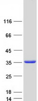 TXNDC9 Protein - Purified recombinant protein TXNDC9 was analyzed by SDS-PAGE gel and Coomassie Blue Staining