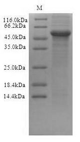 TXNIP Protein - (Tris-Glycine gel) Discontinuous SDS-PAGE (reduced) with 5% enrichment gel and 15% separation gel.