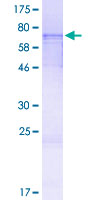 TXNIP Protein - 12.5% SDS-PAGE of human TXNIP stained with Coomassie Blue