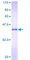 TXNL4A Protein - 12.5% SDS-PAGE of human TXNL4A stained with Coomassie Blue