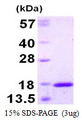 TXNL4A Protein