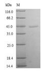 TXNL4B Protein - (Tris-Glycine gel) Discontinuous SDS-PAGE (reduced) with 5% enrichment gel and 15% separation gel.