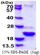 TXNL4B Protein