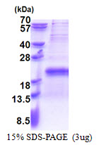 TXNRD3NB Protein