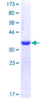 TYK2 Protein - 12.5% SDS-PAGE Stained with Coomassie Blue.