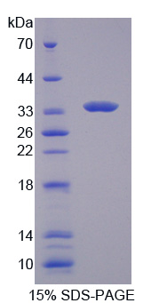 TYK2 Protein - Recombinant Tyrosine Kinase 2 By SDS-PAGE