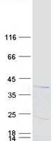 TYMSOS Protein - Purified recombinant protein TYMSOS was analyzed by SDS-PAGE gel and Coomassie Blue Staining
