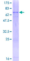 Tyrosinase Protein - 12.5% SDS-PAGE of human TYR stained with Coomassie Blue