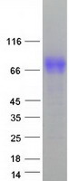 Tyrosinase Protein - Purified recombinant protein TYR was analyzed by SDS-PAGE gel and Coomassie Blue Staining