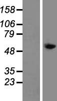 Tyrosine Aminotransferase Protein - Western validation with an anti-DDK antibody * L: Control HEK293 lysate R: Over-expression lysate