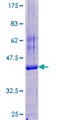 Tyrosine Aminotransferase Protein - 12.5% SDS-PAGE of human TAT stained with Coomassie Blue