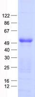 Tyrosine Aminotransferase Protein