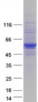 Tyrosine Aminotransferase Protein - Purified recombinant protein TAT was analyzed by SDS-PAGE gel and Coomassie Blue Staining