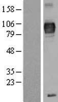 TYRP1 / gp75 Protein - Western validation with an anti-DDK antibody * L: Control HEK293 lysate R: Over-expression lysate