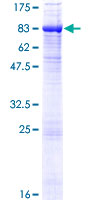 TYRP1 / gp75 Protein - 12.5% SDS-PAGE of human TYRP1 stained with Coomassie Blue