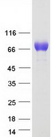 TYRP1 / gp75 Protein - Purified recombinant protein TYRP1 was analyzed by SDS-PAGE gel and Coomassie Blue Staining