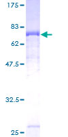 TYW1 Protein - 12.5% SDS-PAGE of human RSAFD1 stained with Coomassie Blue
