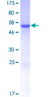 TYW3 Protein - 12.5% SDS-PAGE of human TYW3 stained with Coomassie Blue