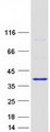 TYW3 Protein - Purified recombinant protein TYW3 was analyzed by SDS-PAGE gel and Coomassie Blue Staining
