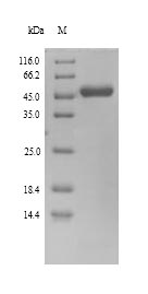 U27 Protein - (Tris-Glycine gel) Discontinuous SDS-PAGE (reduced) with 5% enrichment gel and 15% separation gel.