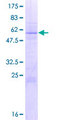 U2AF1 Protein - 12.5% SDS-PAGE of human U2AF1 stained with Coomassie Blue