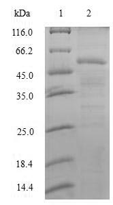 U2AF1 Protein - (Tris-Glycine gel) Discontinuous SDS-PAGE (reduced) with 5% enrichment gel and 15% separation gel.