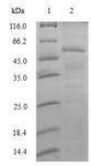 U2AF1 Protein - (Tris-Glycine gel) Discontinuous SDS-PAGE (reduced) with 5% enrichment gel and 15% separation gel.