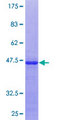 U2AF1 Protein - 12.5% SDS-PAGE Stained with Coomassie Blue.