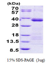 U2AF1 Protein