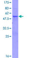 U2AF1L4 Protein - 12.5% SDS-PAGE of human U2AF1L3 stained with Coomassie Blue
