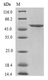 U2AF1L4 Protein - (Tris-Glycine gel) Discontinuous SDS-PAGE (reduced) with 5% enrichment gel and 15% separation gel.