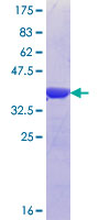 U2AF2 / U2AF65 Protein - 12.5% SDS-PAGE Stained with Coomassie Blue.