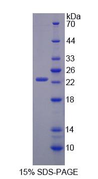 UACA Protein - Recombinant  Uveal Autoantigen With Coiled Coil Domains And Ankyrin Repeats By SDS-PAGE