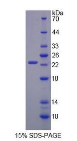 UACA Protein - Recombinant  Uveal Autoantigen With Coiled Coil Domains And Ankyrin Repeats By SDS-PAGE